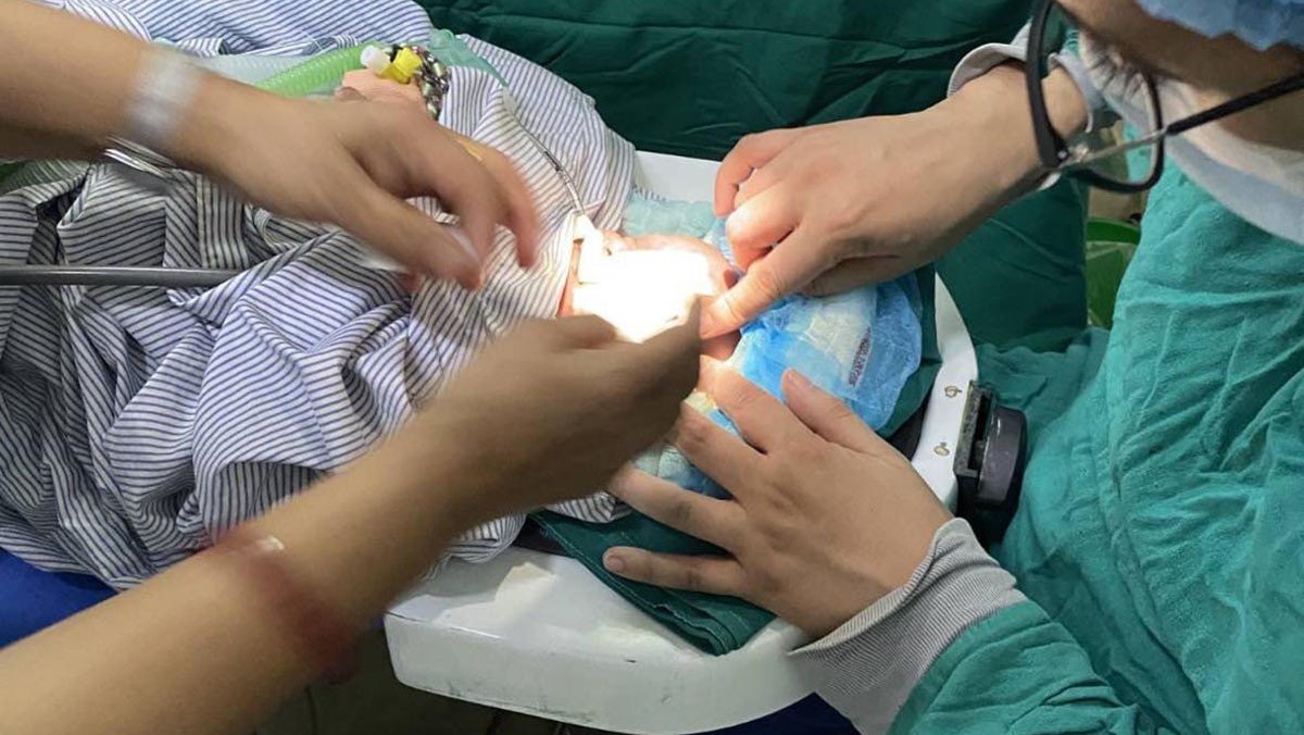 आँखा उपचारमा ऐतिहासिक फड्को : २९ हप्तामा जन्मेको शिशुको ‘लेन्स स्पेयरिङ भिट्रेक्टोमी’ सफल